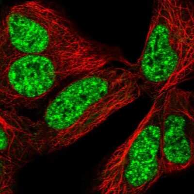 Immunocytochemistry/ Immunofluorescence: CCDC49 Antibody [NBP2-49381]