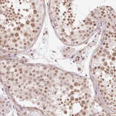 Immunohistochemistry-Paraffin: CCDC49 Antibody [NBP2-49381]