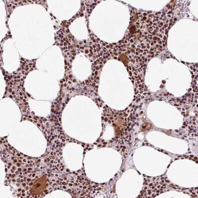 Immunohistochemistry-Paraffin: CCDC49 Antibody [NBP2-49381]