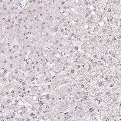 Immunohistochemistry-Paraffin: CCDC49 Antibody [NBP2-49381]