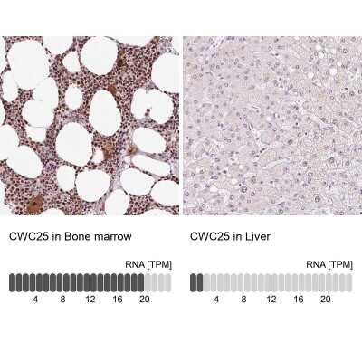 Immunohistochemistry-Paraffin: CCDC49 Antibody [NBP2-49381]