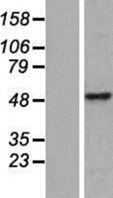 Western Blot: CCDC49 Overexpression Lysate [NBP2-06931]