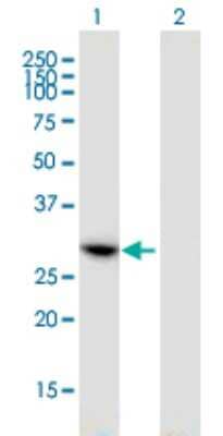 Western Blot: CCDC5 Antibody (1E3) [H00115106-M01]