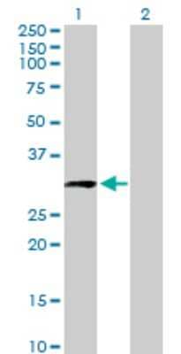 Western Blot: CCDC5 Antibody [H00115106-B01P]