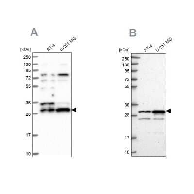 Western Blot: CCDC5 Antibody [NBP1-88158]