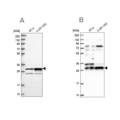 Western Blot: CCDC5 Antibody [NBP1-88159]