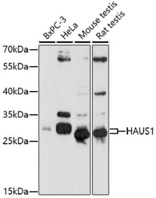 Western Blot: CCDC5 AntibodyAzide and BSA Free [NBP2-92355]