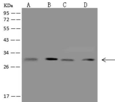 Western Blot: CCDC5 Antibody [NBP3-06419]