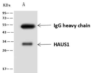 Western Blot: CCDC5 Antibody [NBP3-06419]