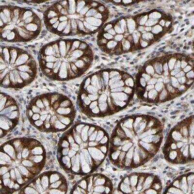 Immunohistochemistry-Paraffin: CCDC51 Antibody [NBP1-82302]