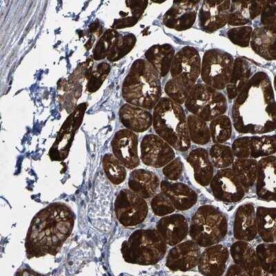 Immunohistochemistry-Paraffin: CCDC51 Antibody [NBP1-82303]