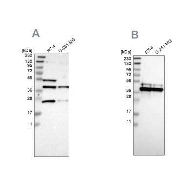 Western Blot: CCDC51 Antibody [NBP1-82302]