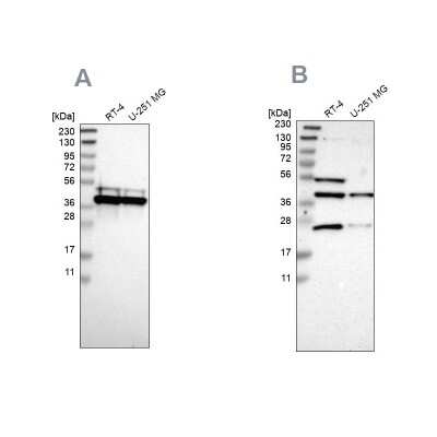 Western Blot: CCDC51 Antibody [NBP1-82303]