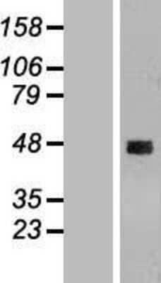 Western Blot: CCDC51 Overexpression Lysate [NBL1-08802]