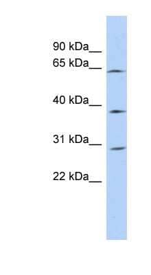 Western Blot: CCDC54 Antibody [NBP1-56379]