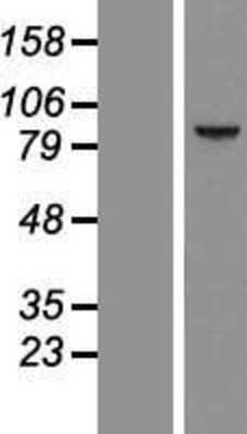 Western Blot: CCDC54 Overexpression Lysate [NBL1-08805]