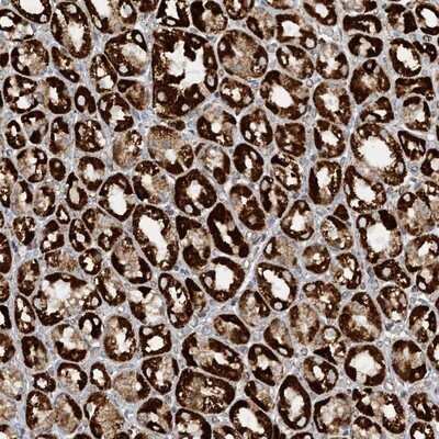 Immunohistochemistry-Paraffin: CCDC56 Antibody [NBP1-81684]