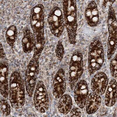 Immunohistochemistry-Paraffin: CCDC56 Antibody [NBP1-81684]