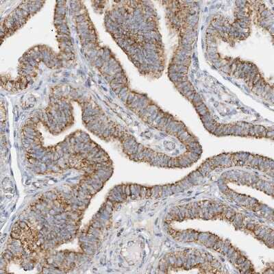 Immunohistochemistry-Paraffin: CCDC56 Antibody [NBP1-81684]