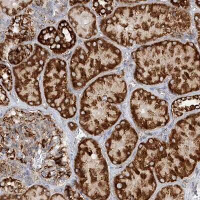 Immunohistochemistry-Paraffin: CCDC56 Antibody [NBP1-81684]