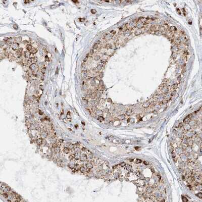 Immunohistochemistry-Paraffin: CCDC56 Antibody [NBP1-81684]