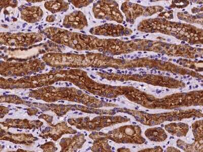 Immunohistochemistry-Paraffin: CCDC56 Antibody [NBP2-98126]