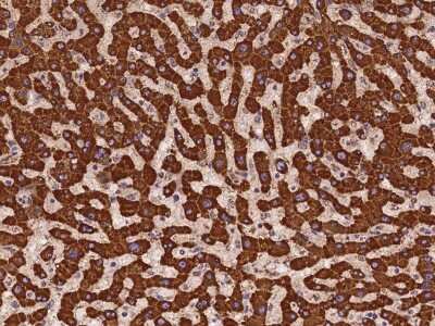 Immunohistochemistry-Paraffin: CCDC56 Antibody [NBP2-98126]