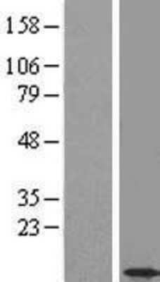 Western Blot: CCDC56 Overexpression Lysate [NBL1-08806]