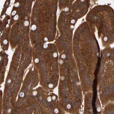 Immunohistochemistry: CCDC57 Antibody [NBP2-48565]