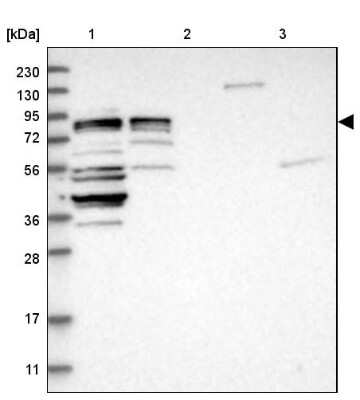 Western Blot: CCDC57 Antibody [NBP2-48566]