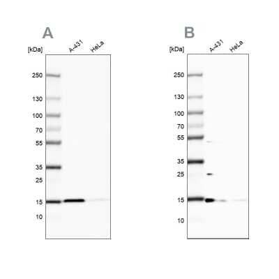 Western Blot: CCDC58 Antibody [NBP2-14452]