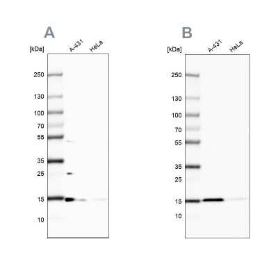 Western Blot: CCDC58 Antibody [NBP2-55464]