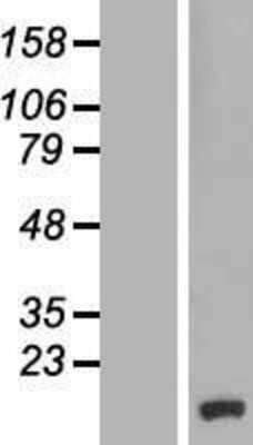 Western Blot: CCDC58 Overexpression Lysate [NBL1-08808]