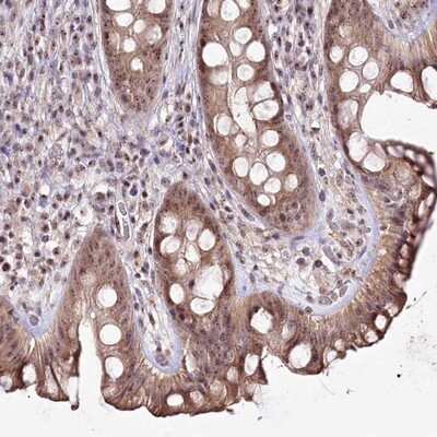 Immunohistochemistry-Paraffin: CCDC59 Antibody [NBP1-88368]