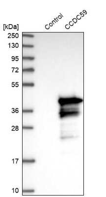 Western Blot: CCDC59 Antibody [NBP1-88368]