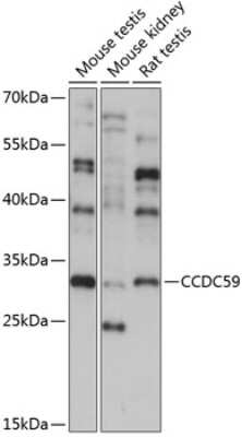 Western Blot: CCDC59 AntibodyAzide and BSA Free [NBP2-92861]