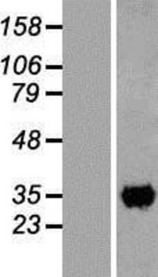 Western Blot: CCDC59 Overexpression Lysate [NBL1-08809]