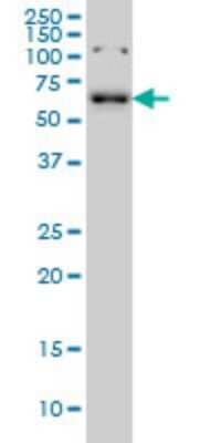 Western Blot: CCDC6 Antibody (5D11) [H00008030-M03]