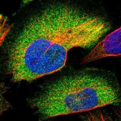 Immunocytochemistry/ Immunofluorescence: CCDC6 Antibody [NBP1-85351]