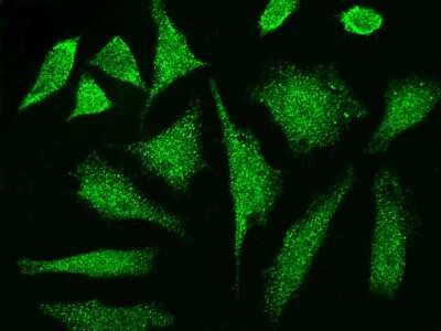 Immunocytochemistry/ Immunofluorescence: CCDC6 Antibody [NBP2-98985]