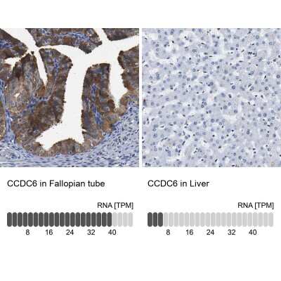Immunohistochemistry-Paraffin: CCDC6 Antibody [NBP1-85350]