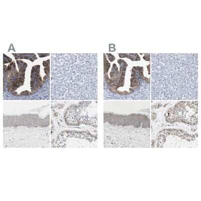 Immunohistochemistry-Paraffin: CCDC6 Antibody [NBP1-85350]