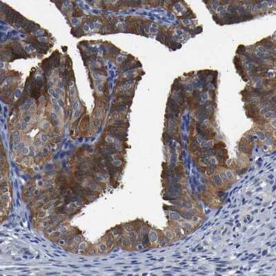 Immunohistochemistry-Paraffin: CCDC6 Antibody [NBP1-85350]