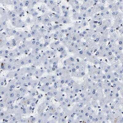 Immunohistochemistry-Paraffin: CCDC6 Antibody [NBP1-85350]