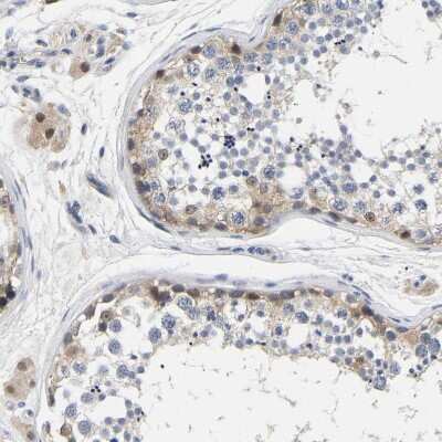 Immunohistochemistry-Paraffin: CCDC6 Antibody [NBP1-85350]