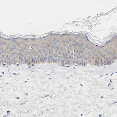 Immunohistochemistry-Paraffin: CCDC6 Antibody [NBP1-85350]
