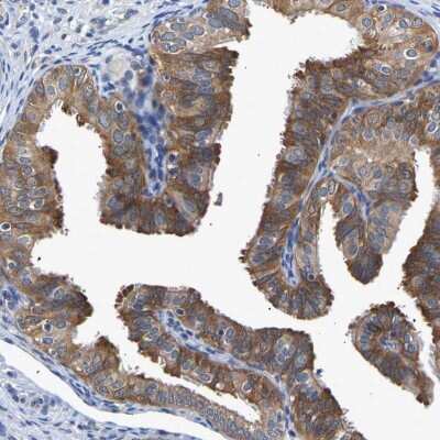 Immunohistochemistry-Paraffin: CCDC6 Antibody [NBP1-85351]