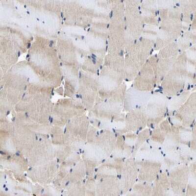 Immunohistochemistry-Paraffin: CCDC6 Antibody [NBP1-85351]