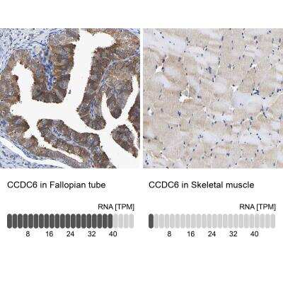 Immunohistochemistry-Paraffin: CCDC6 Antibody [NBP1-85351]