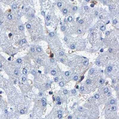 Immunohistochemistry-Paraffin: CCDC6 Antibody [NBP1-85351]